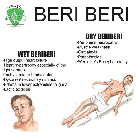 burberry disease|is dry beriberi dangerous.